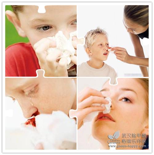 流鼻血應該怎么做,流鼻血的原因,流鼻血注意什么,流鼻血應低頭,流鼻血抬頭錯誤,武漢除甲醛